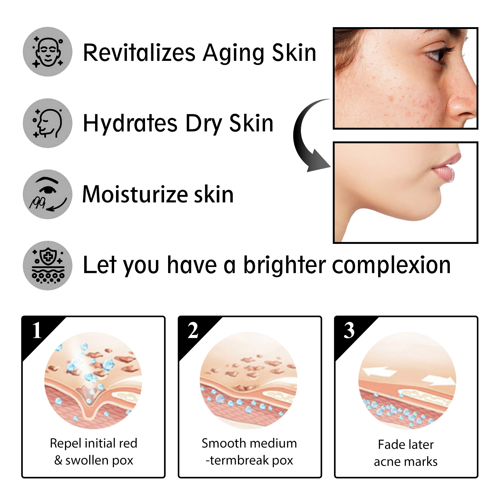 Snail Mucin Cream 92 Daily Moi - Snail Cream Gel 리뷰 및 가격